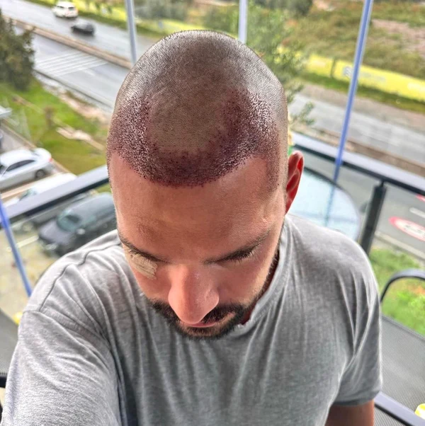 Vlad Gherman are nevoie de recuperare după intervenție / Foto: Instagram