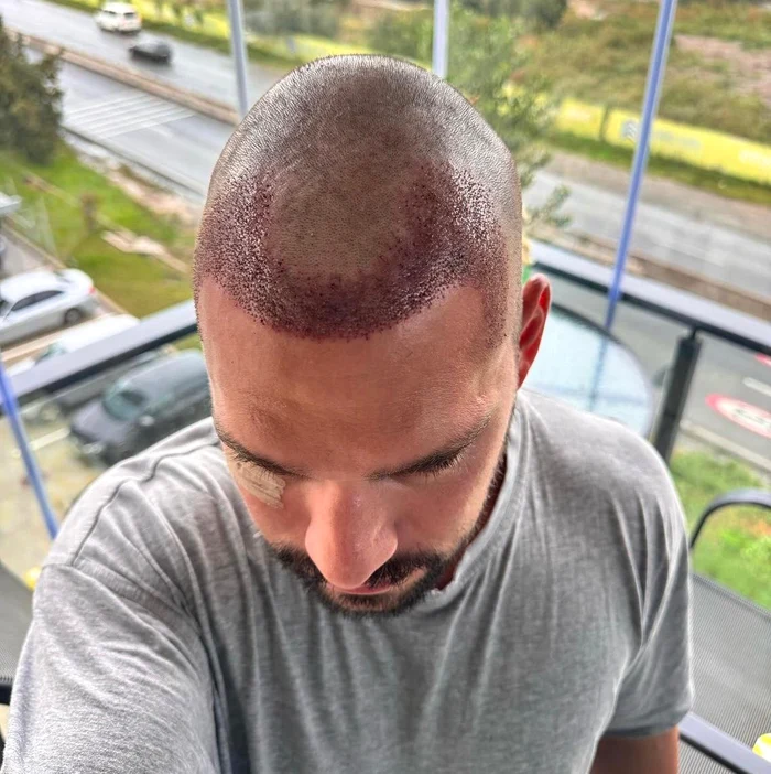 Vlad Gherman are nevoie de recuperare după intervenție / Foto: Instagram