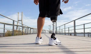 back view man with mechanical leg sunny day sportsman black shorts white sneakers photographed training sport disability hobby concept jpg