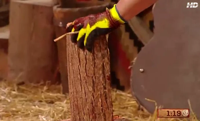 Augustin s-a tăiat serios la mână şi a avut nevoie de îngrijire medicală