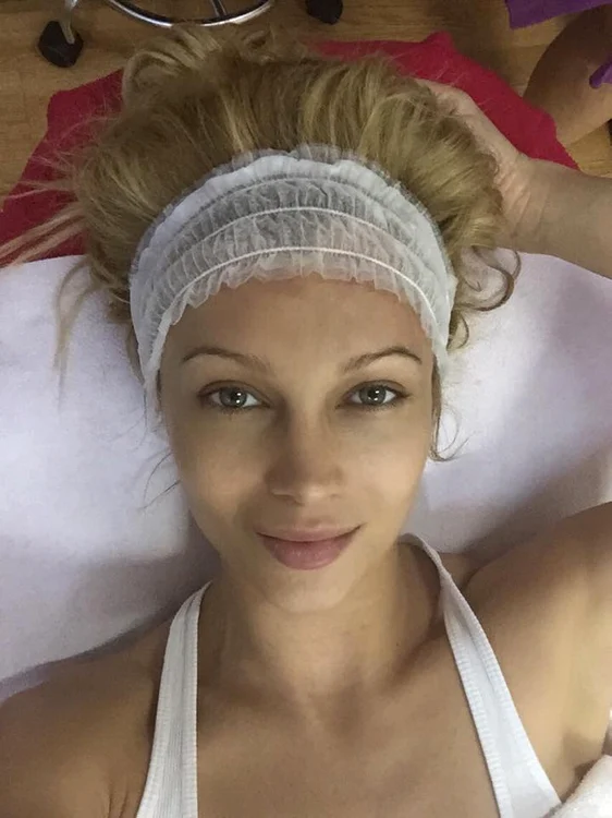 Rezultatele tratamentului facial făcut de Lora