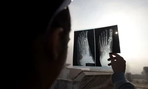 Eclipsa de Soare inelară, privită printr o radiografie jpeg