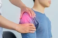 terapia Bowen jpg