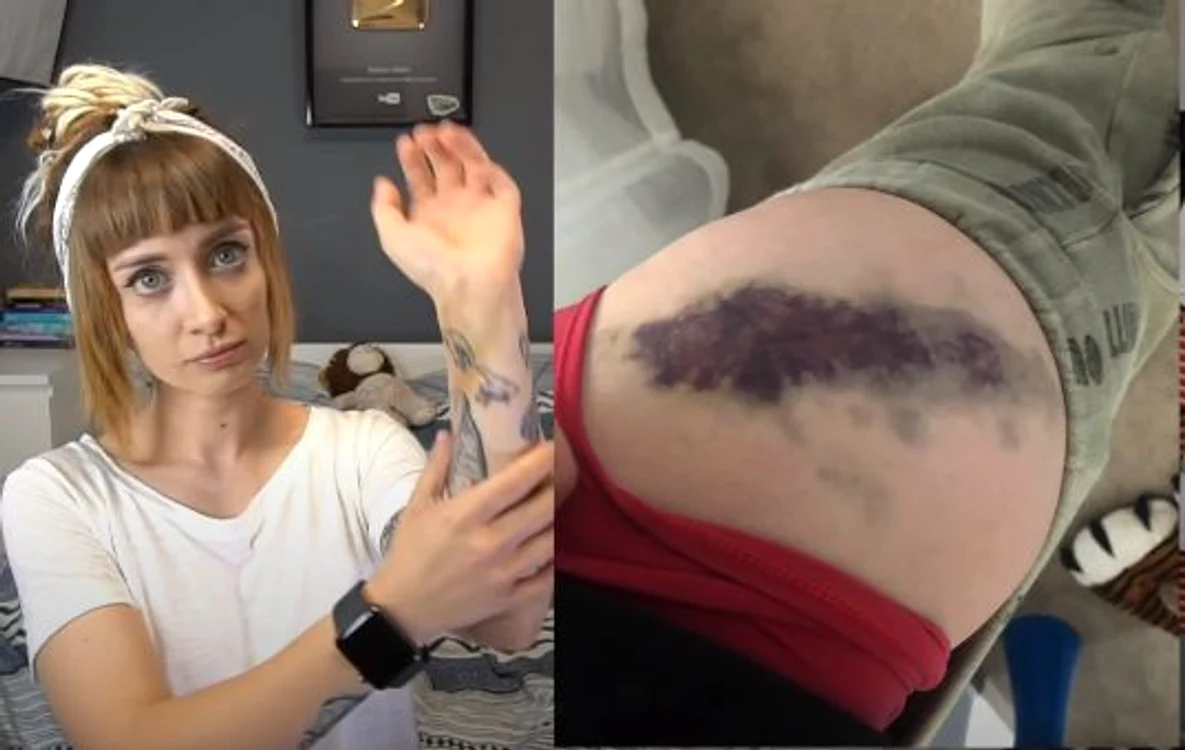 
    Bianca Adam a povestit cu greu trauma prin care a trecutfoto: captură video  