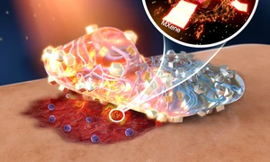 Plasture inteligent care vindecă răni cu ajutorul luminii solare fără antibiotice Foto Cell com dms jpg