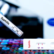Sifilis test foto shutterstock jpg