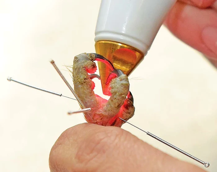 Pentru a putea  merge, a făcut şi  tratament cu laser