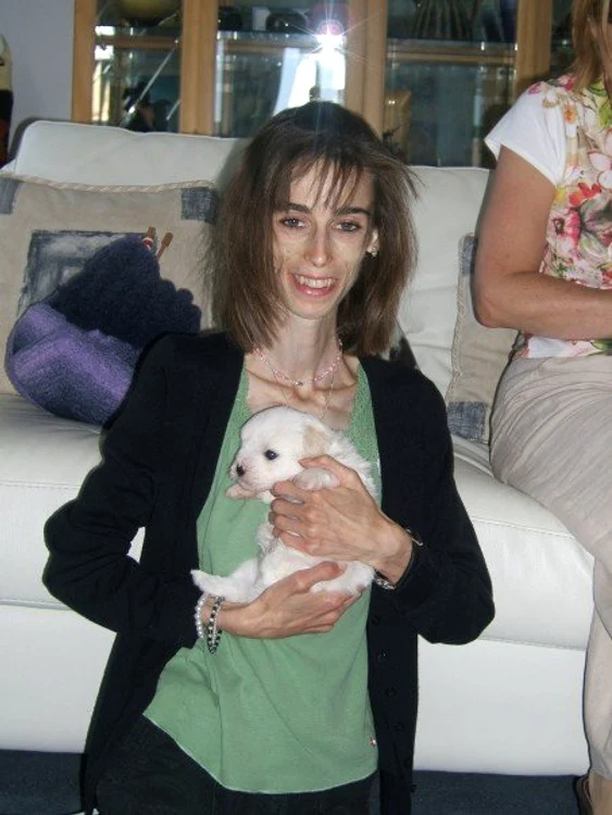Kate Chilver era anorexică FOTO: Facebook