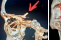 betisoare ct captura video jpg