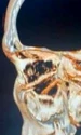 betisoare ct captura video jpg