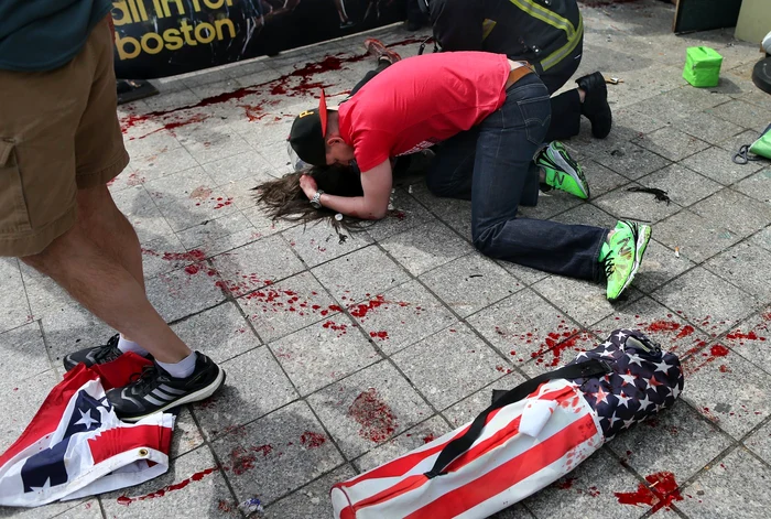 Cel puţin 30 de persoane şi-au pierdut un picior în atentatele de la Boston. FOTOGRAFII: AP