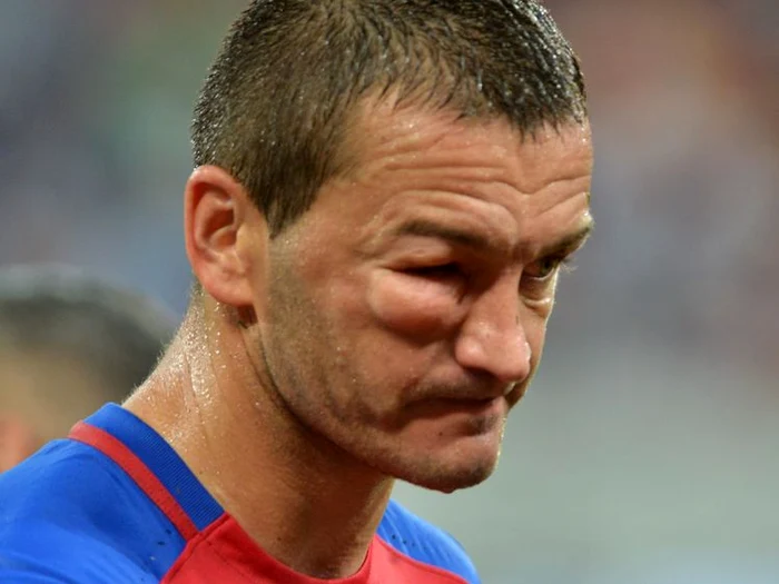 În minutul 8, Golubovic a fost lovit de Fernandinho