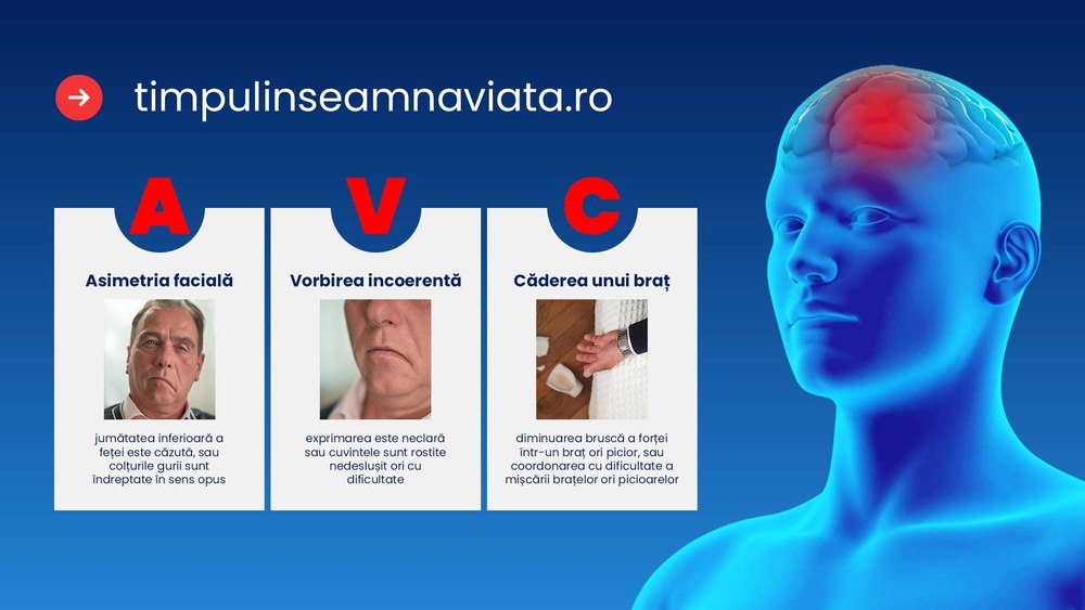 România și lupta contra AVC-ului: de la 14 spitale la o rețea națională de tratament rapid