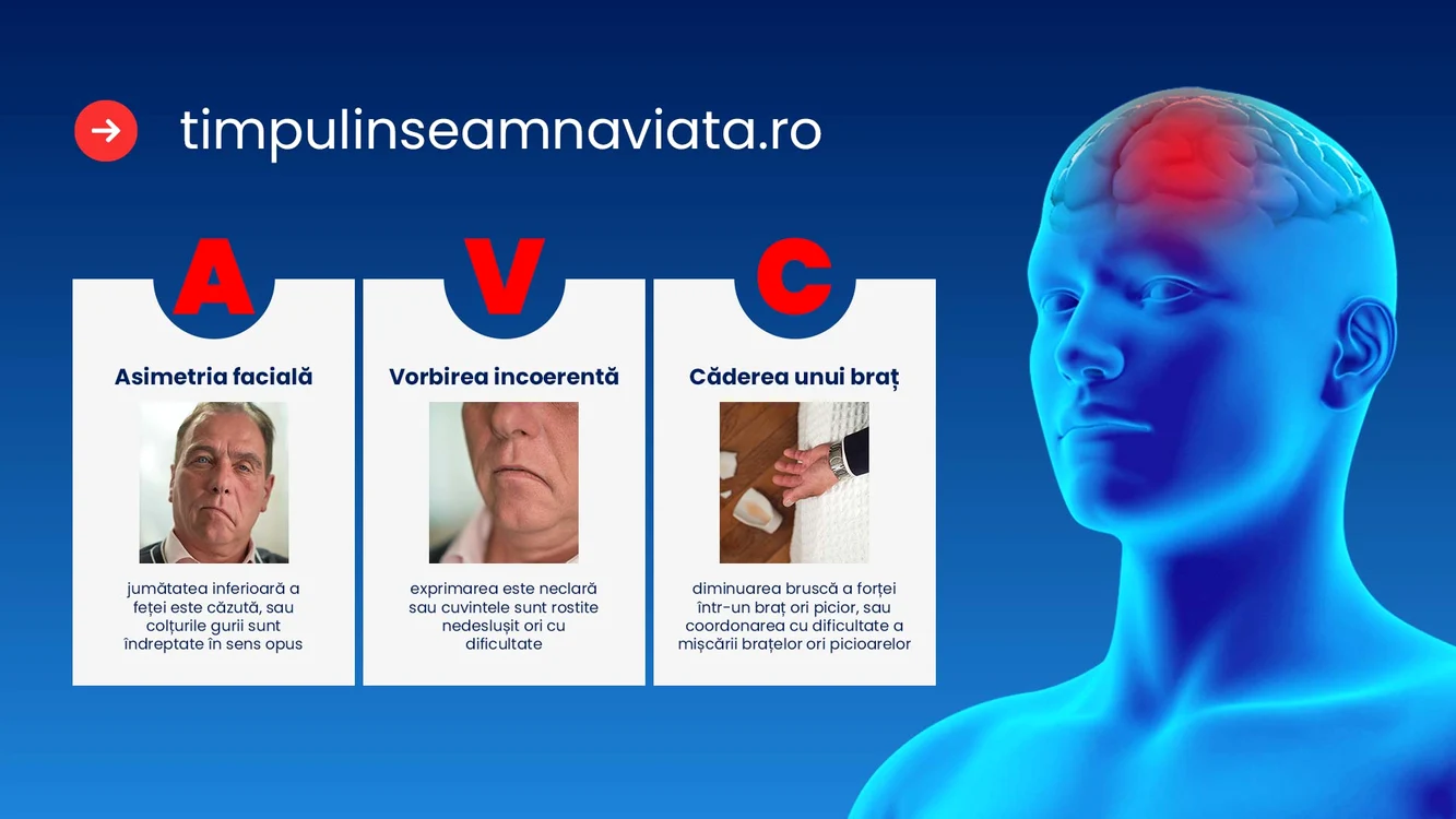 romania i lupta contra avc ului de la 14 spitale la o re ea na ionala de tratament rapid jpg