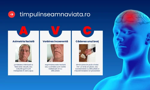 romania i lupta contra avc ului de la 14 spitale la o re ea na ionala de tratament rapid jpg