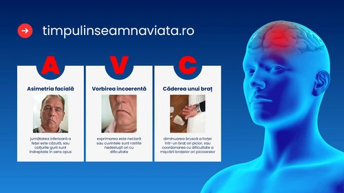 romania i lupta contra avc ului de la 14 spitale la o re ea na ionala de tratament rapid jpg