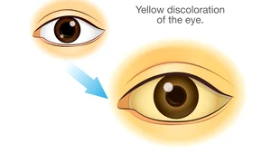 ochi galben 90937458 xxl jpeg