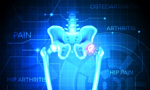 1 71449 original jpg jpeg