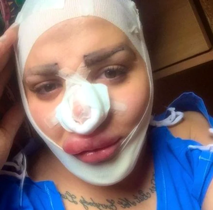 Jordan James Parke crede că operațiile estetice îl vor face să arate precum Kim Kardashian