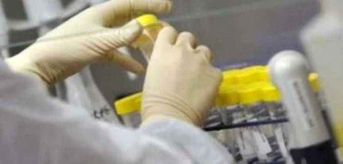 Gripa porcină în România: 5 cazuri confirmate şi un nou suspect - Update