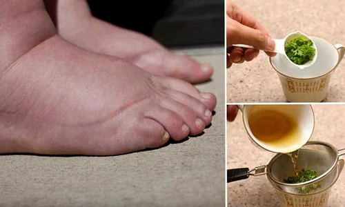 1 cele mai bune remedii pentru reducerea retentiei de apa le ai deja in casa fprn jpg jpeg