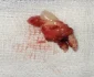 Dinte crescut ideasupra ochiului  Foto AAOJOURNAL (2) webp