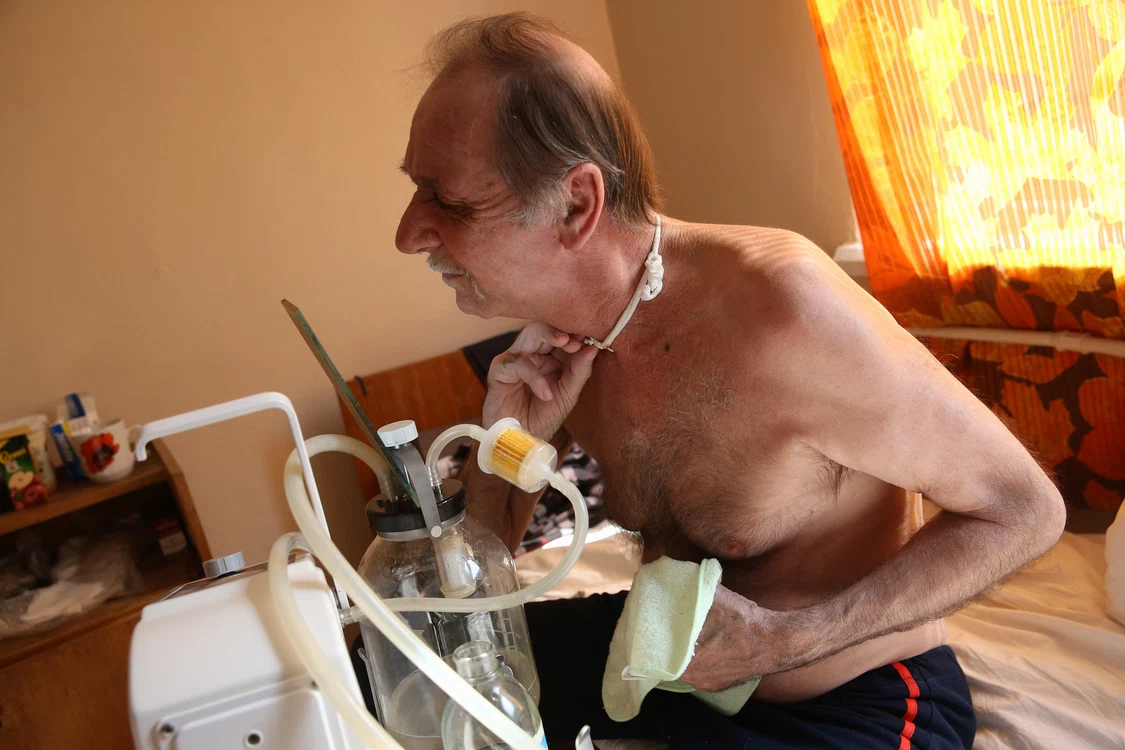 Bolnavii de cancer al gâtului ajung să depindă de mașinării pentru a putea trăi 