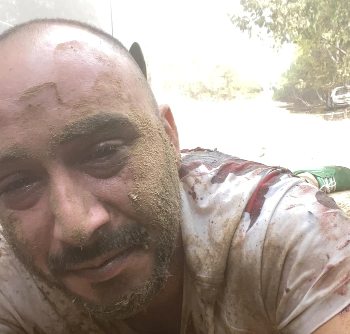  Roei Shalev a supraviețuit atacului Hamas din urmă cu doi ani FOTO: X