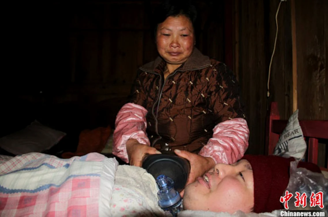 Mama lui Fu Xuepeng renunţă la ventilatorul manual doar seara, când apelează la un aparat făcut manual, dar care nu poate fi folosit mereu din cauza costului prea mare al curentului