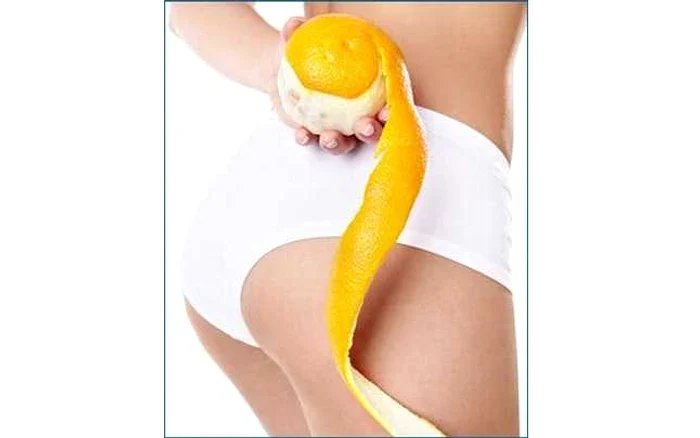 Celulita
