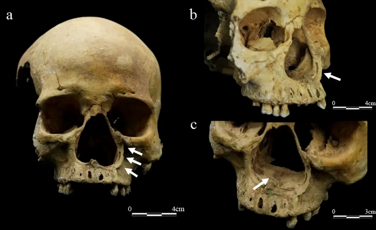 Craniul femeii