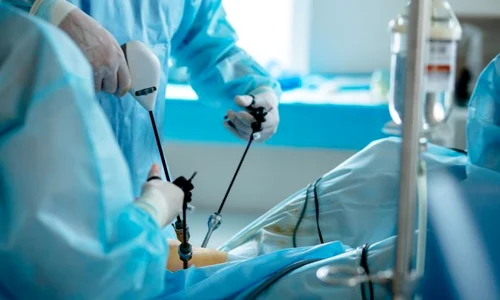 1 laparoscopie jpg jpeg