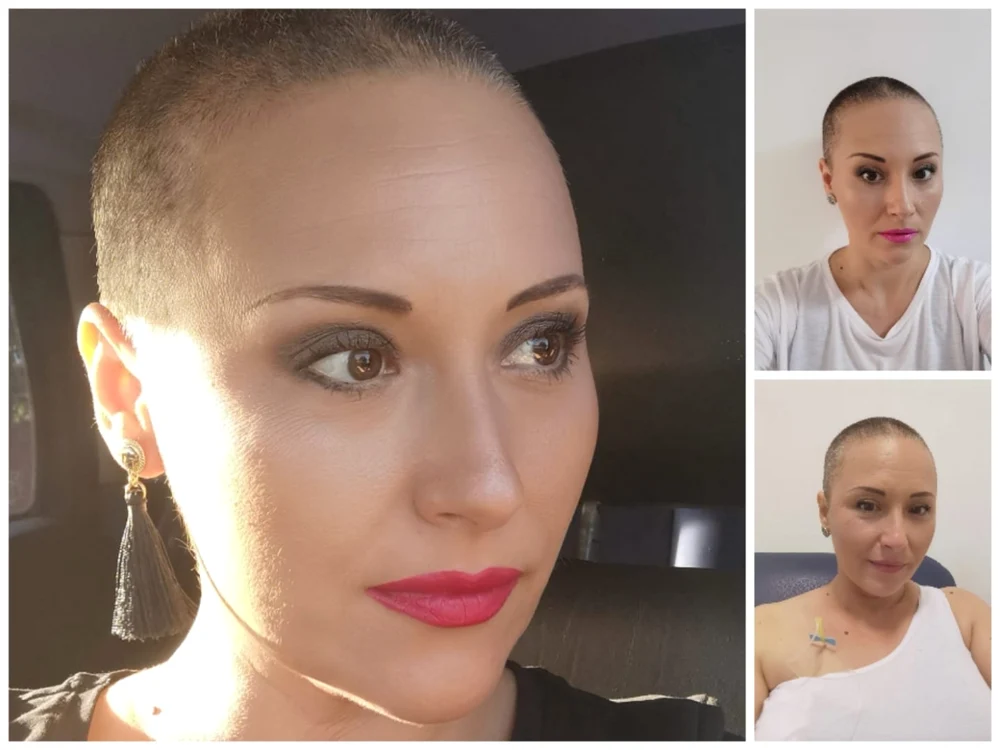ana-maria ciauşu - subprefect olt - a povestit despre experienţa cu cancerul