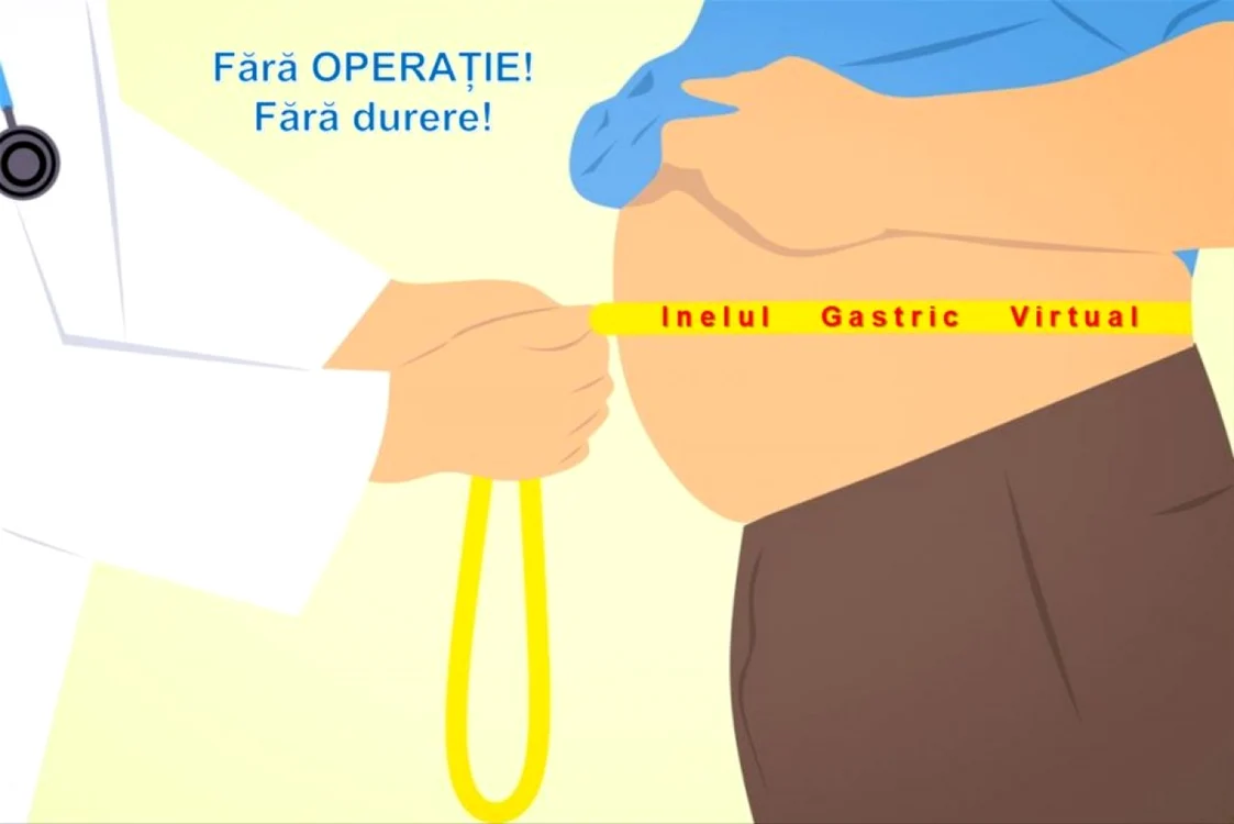 Inelul  Gastic Virtual prin Hipnoză este o tehnică revoluţionară care vine ca alternativă noninvazivă la operaţiile clasice.