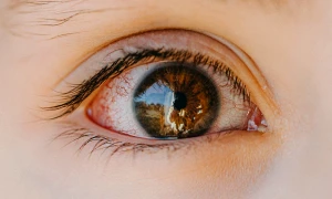 BadEye webp