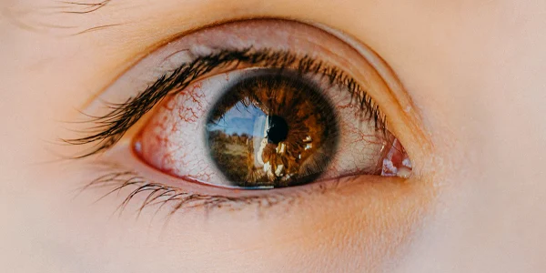 BadEye webp