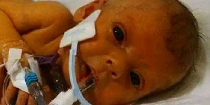 Fotografia cu fetiţa intubată în spital a fost prelucrată în Photoshop de utilizatorii unei reţele sociale