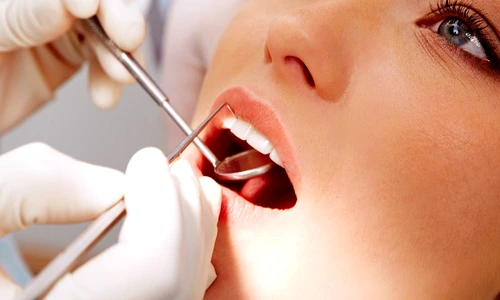 2 coroana dentara raluca manea jpg jpeg