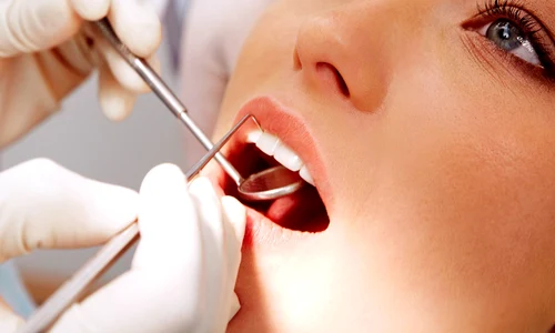 2 coroana dentara raluca manea jpg jpeg