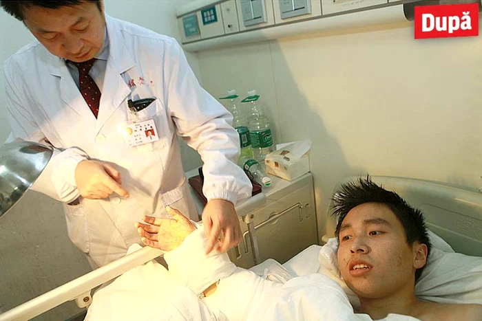 Xiao Wei, înainte de operaţie (Fotografii: Reuters)