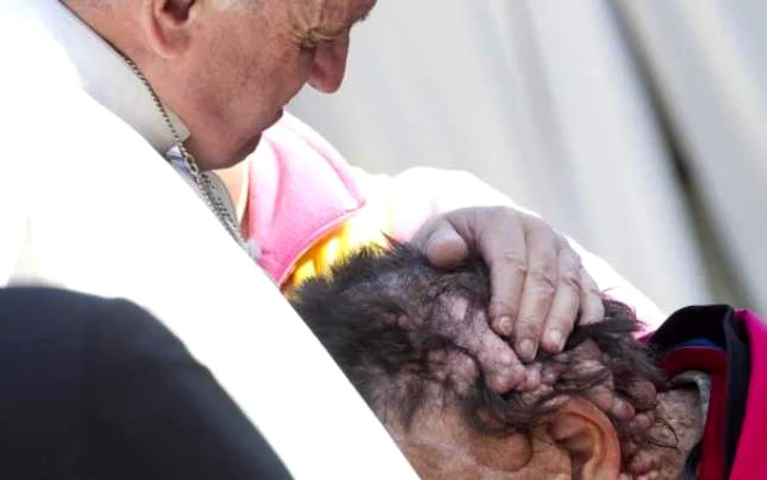 Papa Francisc îmbrăţişând un om desfigurat