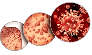 variola maimutei 2 jpg