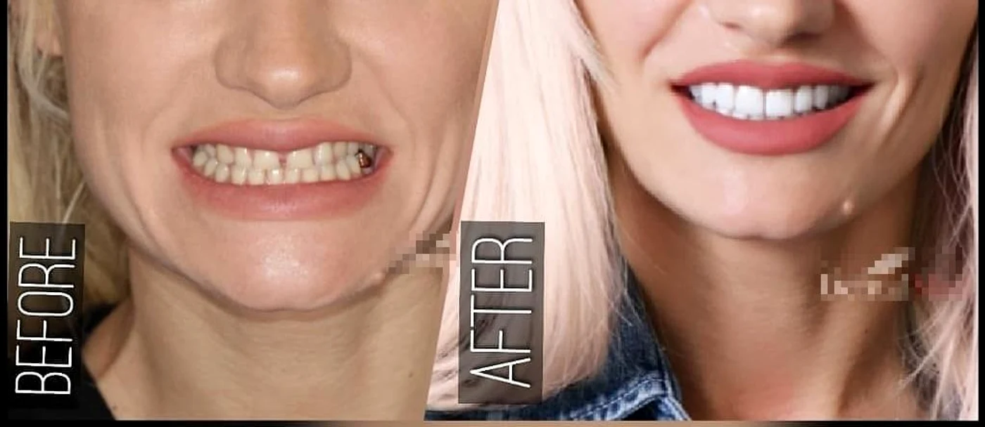 fatete dentare caz 2 jpg