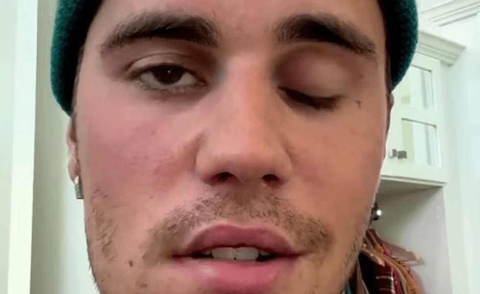Justin Bieber împlinește 29 de ani. Starul cu grave probleme de sănătate, anunț care i-a înfuriat pe fani