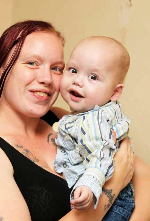 Micuţul, aici alături de mama sa, s-a născut cu o malformaţie rară