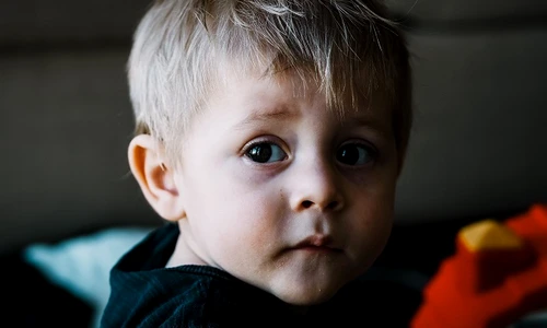 2 boala obrajilor jpg jpeg