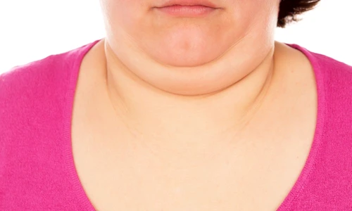 1 74794 original jpg jpeg