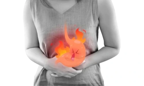 1 tratament gastrita jpg jpeg