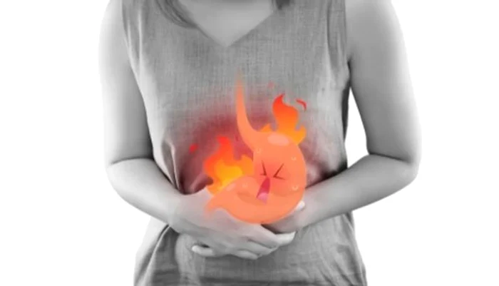 Care este cel mai bun remediu împotriva gastritei și refluxului.