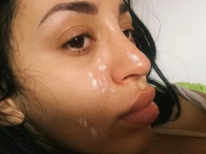 Ruby a găsit soluția pentru a spune adio coșurilor de pe față